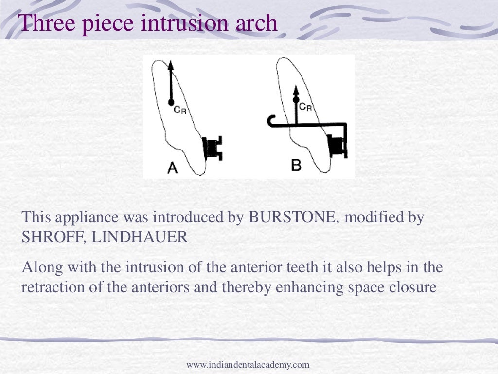 Intrusion mechanic and appliances /certified fixed orthodontic course…