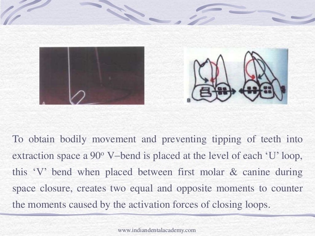 Intrusion mechanic and appliances /certified fixed orthodontic course…