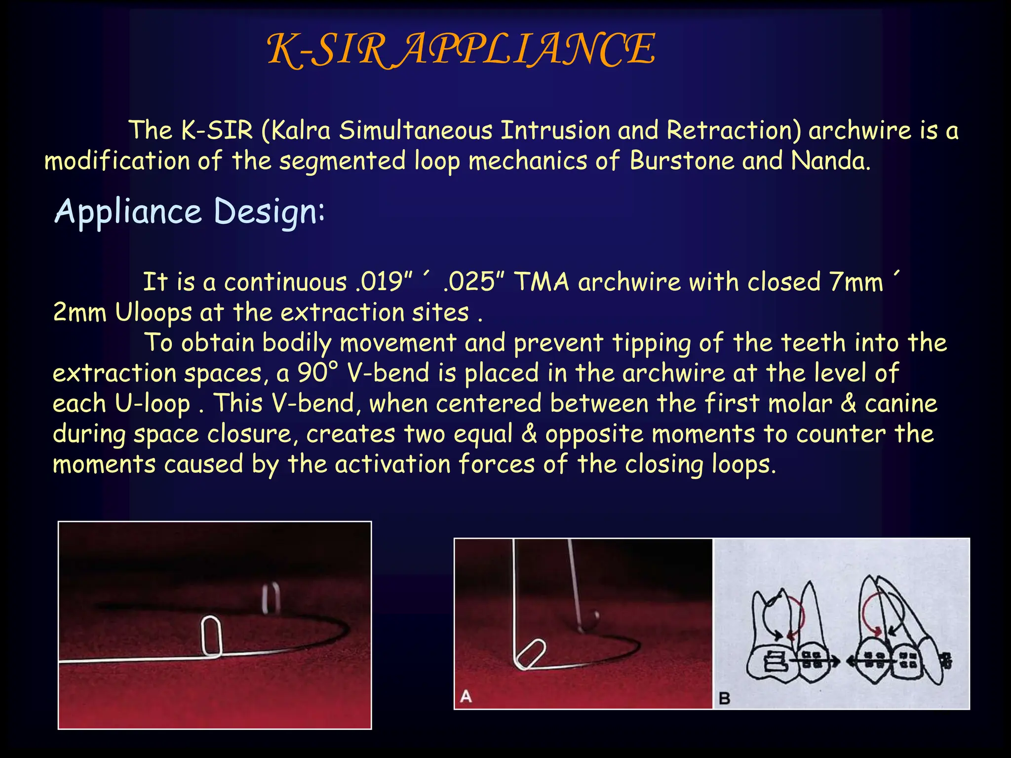 INTRUSION MECHANICS IN ORTHODONTICS..ppt