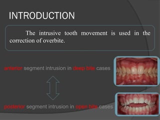 Intrusion mechanics in orthodontics.pptx