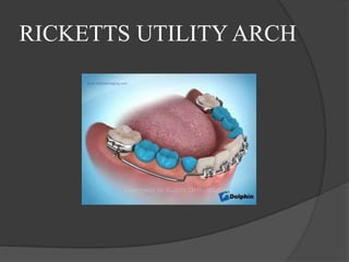 RICKETTS UTILITY ARCH
 