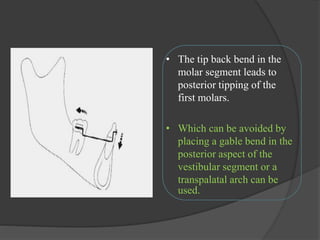 • The tip back bend in the
molar segment leads to
posterior tipping of the
first molars.
• Which can be avoided by
placing a gable bend in the
posterior aspect of the
vestibular segment or a
transpalatal arch can be
used.
 