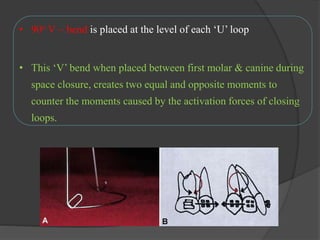 • 90o V  bend is placed at the level of each ‘U’ loop
• This ‘V’ bend when placed between first molar & canine during
space closure, creates two equal and opposite moments to
counter the moments caused by the activation forces of closing
loops.
 