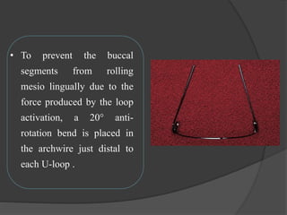 • To prevent the buccal
segments from rolling
mesio lingually due to the
force produced by the loop
activation, a 20° anti-
rotation bend is placed in
the archwire just distal to
each U-loop .
 