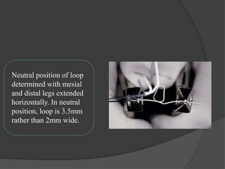Neutral position of loop
determined with mesial
and distal legs extended
horizontally. In neutral
position, loop is 3.5mm
rather than 2mm wide.
 