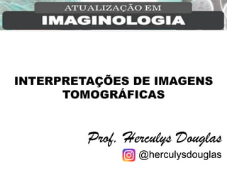 INTERPRETAÇÕES DE IMAGENS
TOMOGRÁFICAS
Prof. Herculys Douglas
@herculysdouglas
 