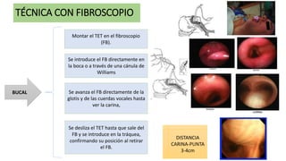 INTUBACIÓN CON FIBROSCOPIO.pptx