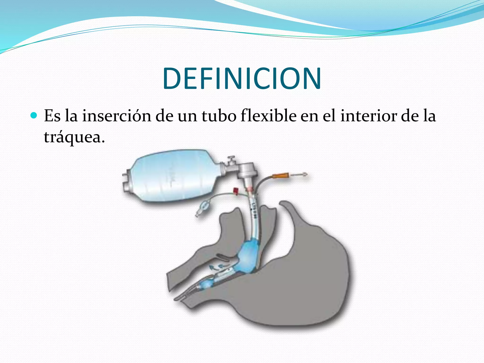 INTUBACIÓN ENDOTRAQUEAL.pptx