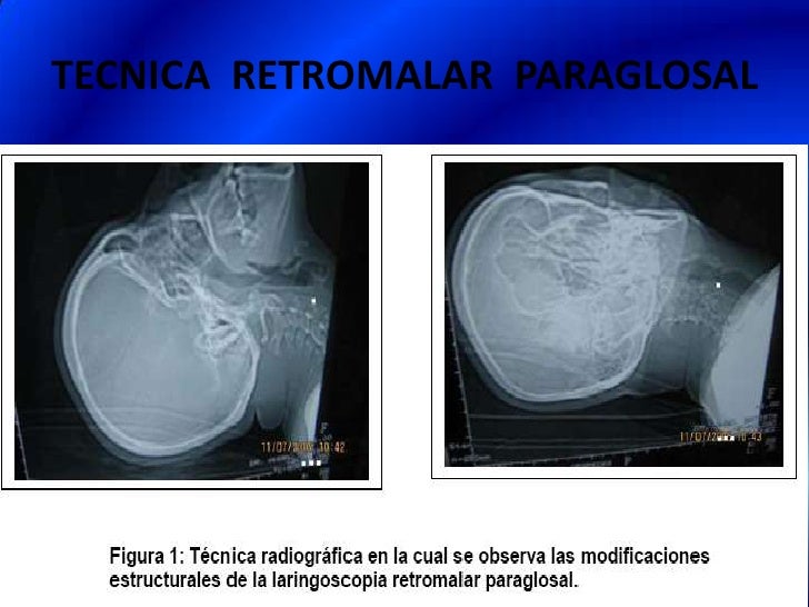 difícil muscular difícil muscular
