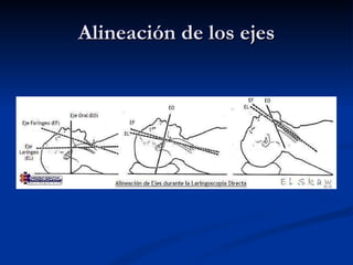 Alineación de los ejes 