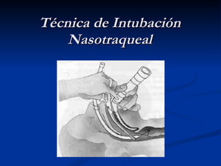 Técnica de Intubación Nasotraqueal 