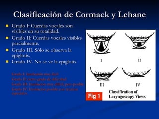 Clasificación de Cormack y Lehane Grado I: Cuerdas vocales son visibles en su totalidad. Grado II: Cuerdas vocales visibles parcialmente.  Grado III. Sólo se observa la epiglotis.  Grado IV. No se ve la epiglotis Grado I: Intubación muy fácil  Grado II:  cierto grado de dificultad Grado III: Intubación muy difícil, pero posible Grado IV: Intubación posible con técnicas especiales. 
