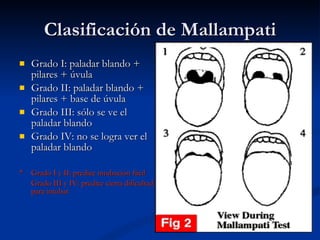 Clasificación de Mallampati Grado I: paladar blando + pilares + úvula Grado II: paladar blando + pilares + base de úvula Grado III: sólo se ve el paladar blando  Grado IV: no se logra ver el paladar blando * Grado I y II: predice intubación fácil Grado III y IV: predice cierta dificultad para intubar 