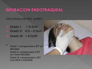 INTUBACION ENDOTRAQUEALCormack II: Visualización de epiglotisy aritenoides.