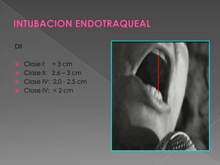 INTUBACION ENDOTRAQUEALCormack IV:No se ve nada.