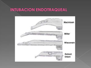 INTUBACION ENDOTRAQUEAL