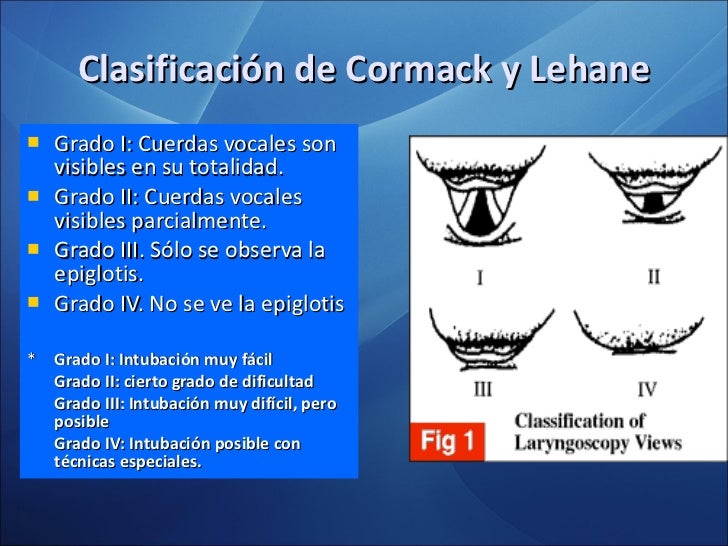 Intubacion endotraqueal