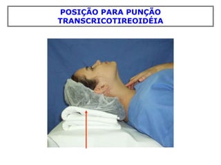 POSIÇÃO PARA PUNÇÃO
TRANSCRICOTIREOIDÉIA
 