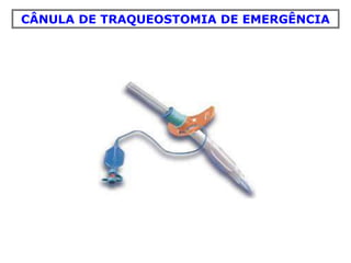 CÂNULA DE TRAQUEOSTOMIA DE EMERGÊNCIA
 