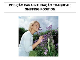 POSIÇÃO PARA INTUBAÇÃO TRAQUEAL:
SNIFFING POSITION
 
