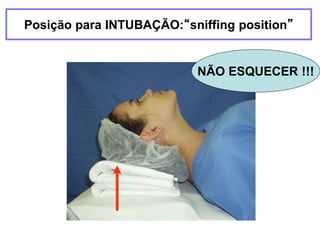 Posição para INTUBAÇÃO:“sniffing position”
NÃO ESQUECER !!!
 