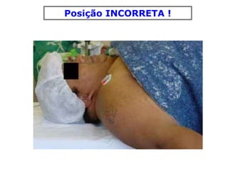 Posição INCORRETA !
 