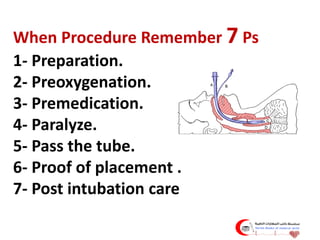 التنبيب الرغامي Intubation.pdf