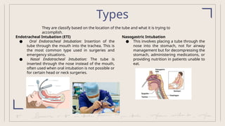 Intubation - describtion, diagnosis and management | PPTX