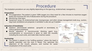 Intubation - describtion, diagnosis and management | PPTX