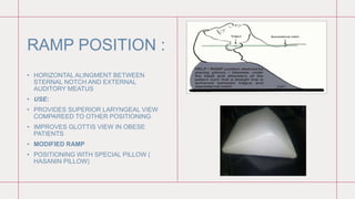 Intubation Ramping INTUBATION DR.MANISHA(RSI & DSI).pptx ppt | PPTX
