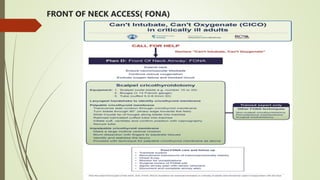 FRONT OF NECK ACCESS( FONA)
 