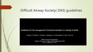 Difficult Airway Society( DAS) guidelines
 