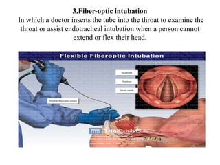 3.Fiber-optic intubation
In which a doctor inserts the tube into the throat to examine the
throat or assist endotracheal intubation when a person cannot
extend or flex their head.
 