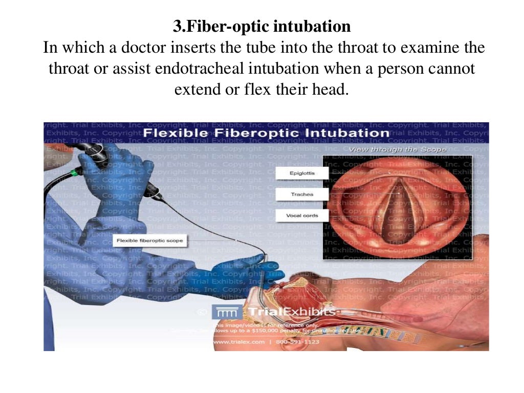 Intubation ppt