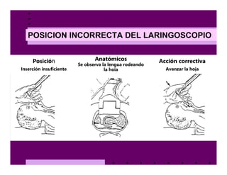 Intubación endotraqueal | PDF