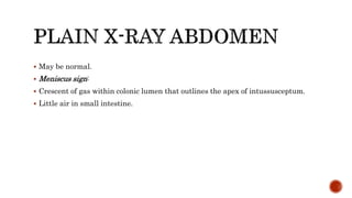 May be normal.
 Meniscus sign:
 Crescent of gas within colonic lumen that outlines the apex of intussusceptum.
 Little air in small intestine.
 