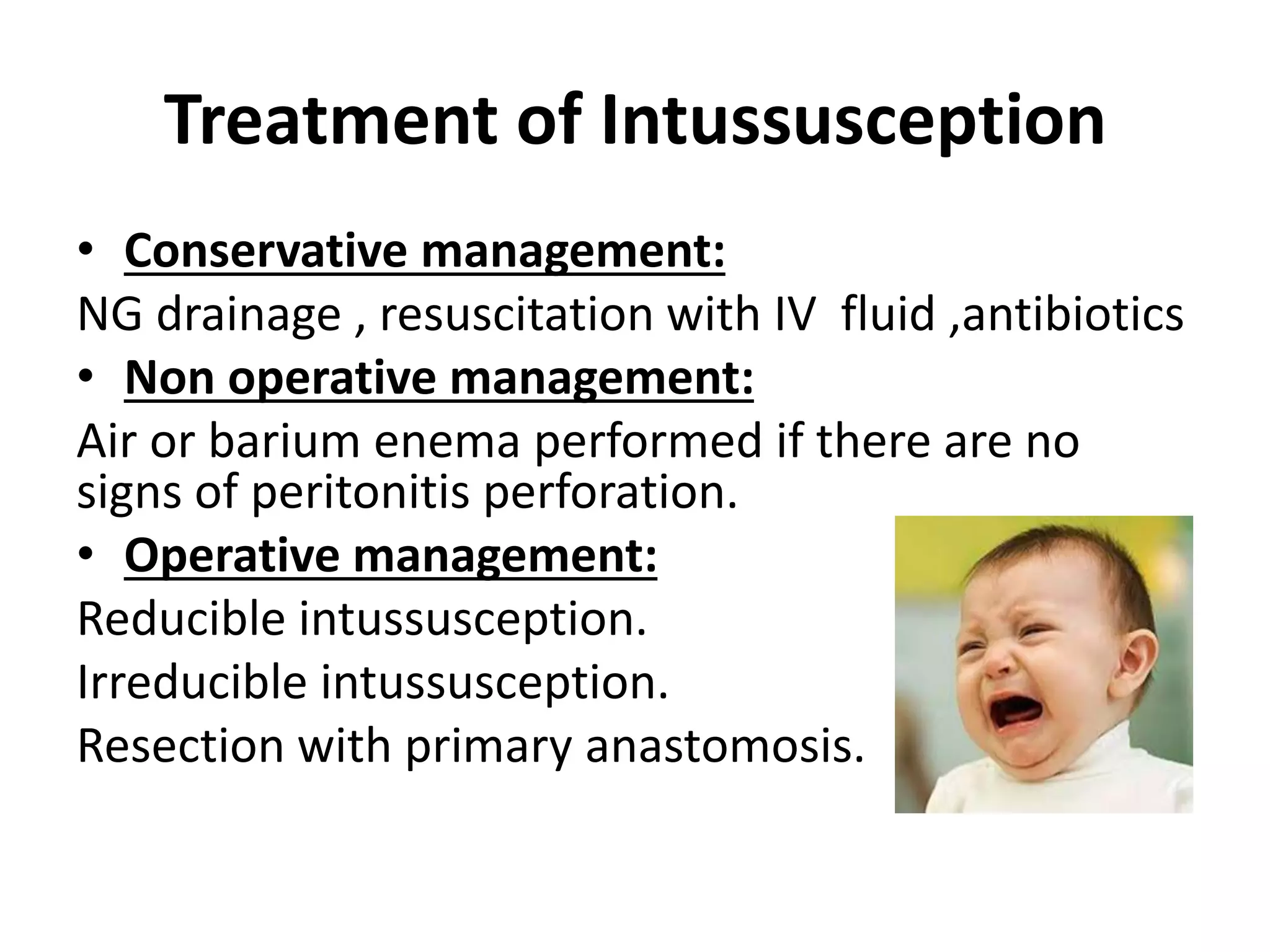 Intussusception PPT