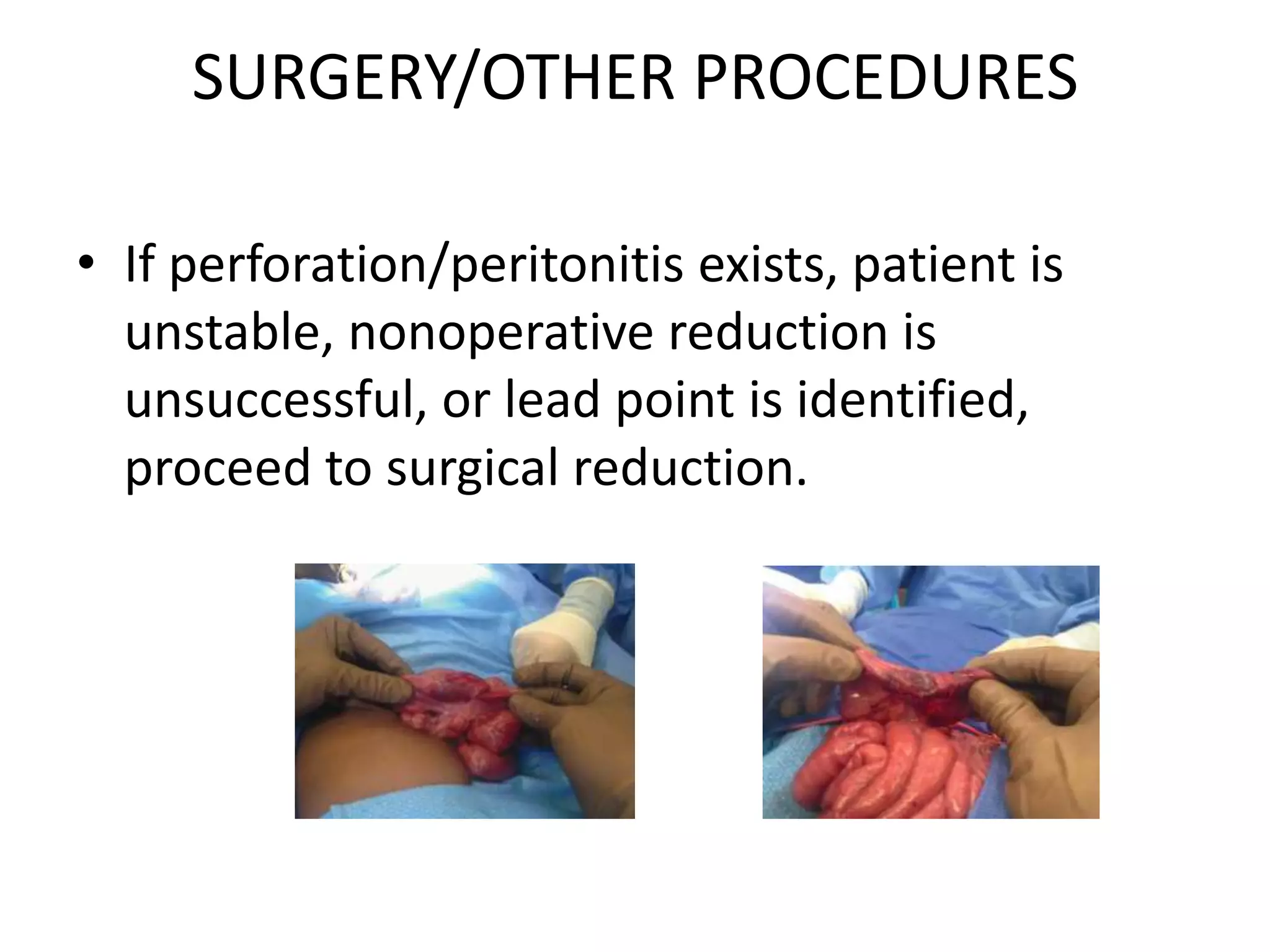 SURGERY/OTHER PROCEDURES
• If perforation/peritonitis exists, patient is
unstable, nonoperative reduction is
unsuccessful, or lead point is identified,
proceed to surgical reduction.
 