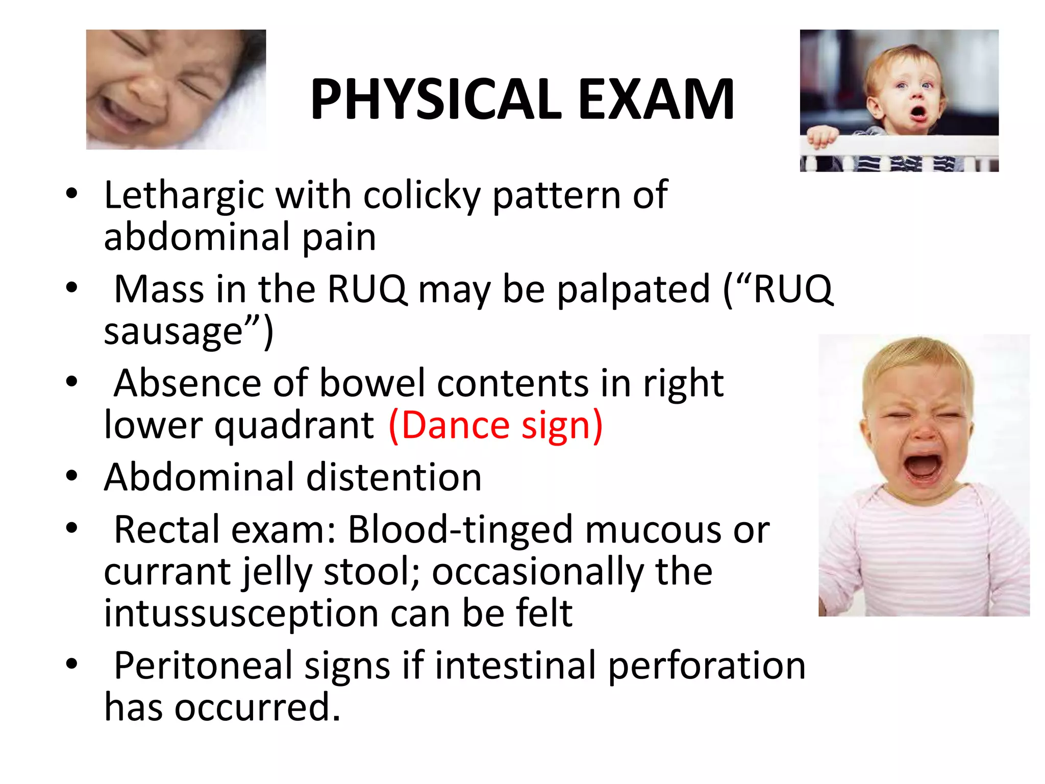 PHYSICAL EXAM
• Lethargic with colicky pattern of
abdominal pain
• Mass in the RUQ may be palpated (“RUQ
sausage”)
• Absence of bowel contents in right
lower quadrant (Dance sign)
• Abdominal distention
• Rectal exam: Blood-tinged mucous or
currant jelly stool; occasionally the
intussusception can be felt
• Peritoneal signs if intestinal perforation
has occurred.
 