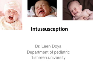 Intussusception
Dr. Leen Doya
Department of pediatric
Tishreen university
 