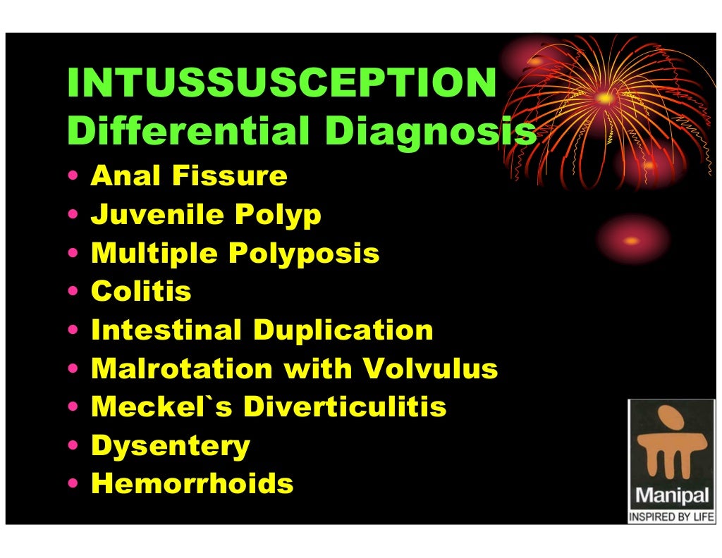 Pediatric Intussusception An Overview