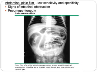 Abdominal plain film – low sensitivity and specificity
 Signs of intestinal obstruction
 Pneumoperitoneum
 