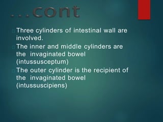 Three cylinders of intestinal wall are
involved.
The inner and middle cylinders are
the invaginated bowel
(intussusceptum)
The outer cylinder is the recipient of
the invaginated bowel
(intussuscipiens)
 