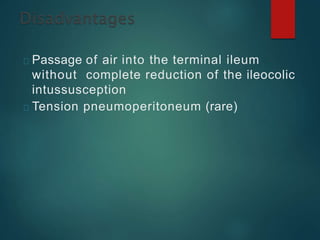 Passage of air into the terminal ileum
without complete reduction of the ileocolic
intussusception
Tension pneumoperitoneum (rare)
 