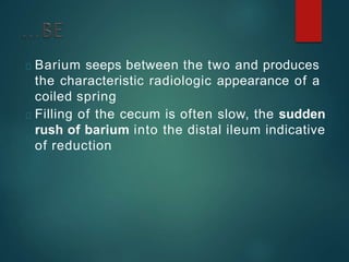 Barium seeps between the two and produces
the characteristic radiologic appearance of a
coiled spring
Filling of the cecum is often slow, the sudden
rush of barium into the distal ileum indicative
of reduction
 