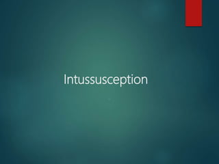 Intussusception
.
 