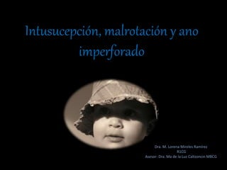 Intusucepción, malrotación y ano
imperforado
Dra. M. Lorena Mireles Ramírez
R1CG
Asesor: Dra. Ma de la Luz Caltzoncin MBCG
 