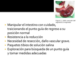  Manipular el intestino con cuidado,
traicionando el punto guía de regreso a su
posición normal
 Resistencia a la reducción
 Necesidad de resección, daño vascular grave.
 Paquetes tibios de solución salina
 Exploración para búsqueda de un punto guía
y tomar medidas adecuadas
 