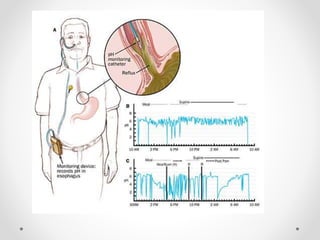 Investigations - esophagus