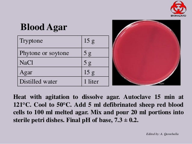 How To Prepare Defibrinated Blood Agar? – WFIJTD